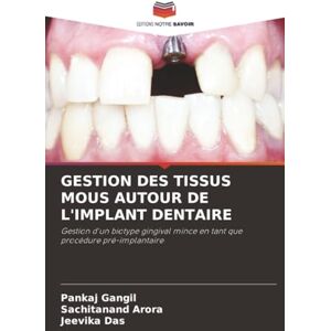 Gangil, Pankaj GESTION DES TISSUS MOUS AUTOUR DE L'IMPLANT DENTAIRE: Gestion d'un biotype gingival mince en tant que procédure pré-implantaire Gangil, Pankaj GESTION DES TISSUS MOUS AUTOUR DE L'IMPLANT DENTAIRE: Gestion d'un biotype gingival mince en tant que procédure pré-implantaire