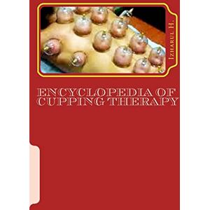 H., Izharul Encyclopedia of Cupping Therapy: Al-Hijama H., Izharul Encyclopedia of Cupping Therapy: Al-Hijama