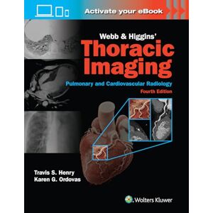 Scott Webb & Higgins Thoracic Imaging: Print + eBook with Multimedia Scott Webb & Higgins Thoracic Imaging: Print + eBook with Multimedia