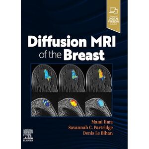 Elsevier DIFFUSION MRI OF THE BREAST, E-Book Elsevier DIFFUSION MRI OF THE BREAST, E-Book