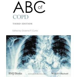 ABC of COPD (ABC Series) ABC of COPD (ABC Series)