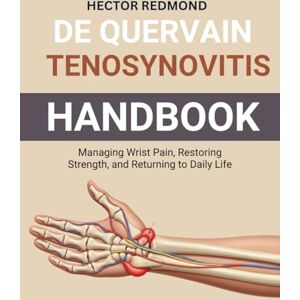 Redmond, Hector Mast Cell and Histamine Reset: A Clear Guide to Triggers, Tolerance, and Everyday Balance Redmond, Hector Mast Cell and Histamine Reset: A Clear Guide to Triggers, Tolerance, and Everyday Balance