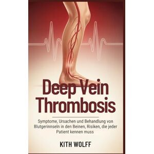 Wolff, Kith Deep Vein Thrombosis: Symptome, Ursachen und Behandlung von Blutgerinnseln in den Beinen, Risiken, die jeder Patient kennen muss Wolff, Kith Deep Vein Thrombosis: Symptome, Ursachen und Behandlung von Blutgerinnseln in den Beinen, Risiken, die jeder Patient kennen muss