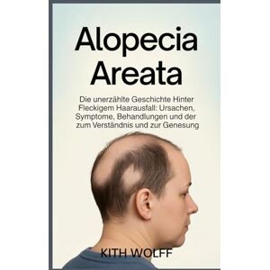 Wolff, Kith Alopecia Areata: Die unerzählte Geschichte hinter fleckigem Haarausfall: Ursachen, Symptome, Behandlungen und der Weg zum Verständnis und zur Genesung Wolff, Kith Alopecia Areata: Die unerzählte Geschichte hinter fleckigem Haarausfall: Ursachen, Symptome, Behandlungen und der Weg zum Verständnis und zur Genesung