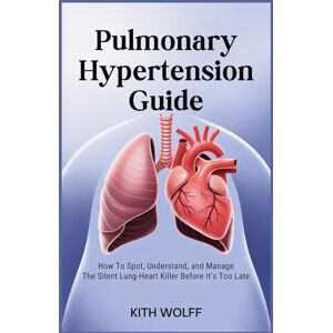 Wolff, Kith Pulmonary Hypertension Guide: How to Spot, Understand, and Manage the Silent Lung-Heart Killer Before It’s Too Late Wolff, Kith Pulmonary Hypertension Guide: How to Spot, Understand, and Manage the Silent Lung-Heart Killer Before It’s Too Late