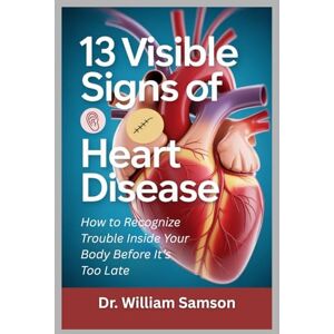 Samson 13 VISIBLE SIGNS OF HEART DISEASE: How to Recognize Trouble Inside Your Body Before It’s Too Late Samson 13 VISIBLE SIGNS OF HEART DISEASE: How to Recognize Trouble Inside Your Body Before It’s Too Late