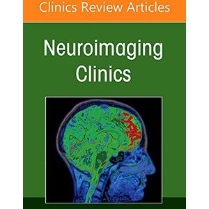 Allied Neuroimaging Anatomy, Part 1: Brain and Skull, An Issue of Neuroimaging Clinics of North America (Volume 32-3) (The Clinics: Internal Medicine, Volume 32-3) Allied Neuroimaging Anatomy, Part 1: Brain and Skull, An Issue of Neuroimaging Clinics of North America (Volume 32-3) (The Clinics: Internal Medicine, Volume 32-3)