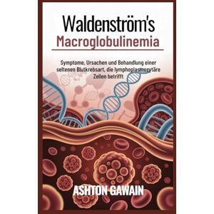 Ashton Waldenström’s Macroglobulinemia: Symptome, Ursachen und Behandlung einer seltenen Blutkrebsart, die lymphoplasmozytäre Zellen betrifft Ashton Waldenström’s Macroglobulinemia: Symptome, Ursachen und Behandlung einer seltenen Blutkrebsart, die lymphoplasmozytäre Zellen betrifft