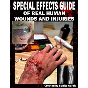 Garcia III, Mr Benito Special Effects Guide Of Real Human Wounds and Injuries: Special Effects Guide Of Real Human Wounds and Injuries Garcia III, Mr Benito Special Effects Guide Of Real Human Wounds and Injuries: Special Effects Guide Of Real Human Wounds and Injuries
