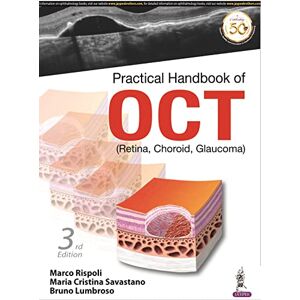 Rispoli, Marco Practical Handbook of OCT: (Retina, Choroid, Glaucoma) Rispoli, Marco Practical Handbook of OCT: (Retina, Choroid, Glaucoma)