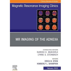Elsevier MR Imaging of the Adnexa, An Issue of Magnetic Resonance Imaging Clinics of North America, E-Book (The Clinics: Radiology) Elsevier MR Imaging of the Adnexa, An Issue of Magnetic Resonance Imaging Clinics of North America, E-Book (The Clinics: Radiology)