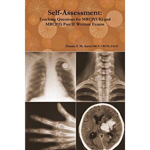 Amin, Osama S. M. Self-Assessment: Teaching Questions for MRCP(UK) and MRCP(I) Part II Written Exams Amin, Osama S. M. Self-Assessment: Teaching Questions for MRCP(UK) and MRCP(I) Part II Written Exams