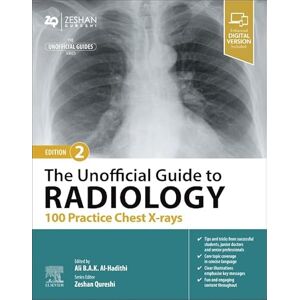 Allied The Unofficial Guide to Radiology: 100 Practice Chest X-rays (Unofficial Guides) Allied The Unofficial Guide to Radiology: 100 Practice Chest X-rays (Unofficial Guides)