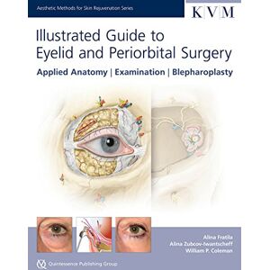 Fratila, Alina Illustrated Guide to Eyelid and Periorbital Surgery: Applied Anatomy,Examination, Blepharoplasty (Aesthetic Methods for Skin Rejuvenation Series) Fratila, Alina Illustrated Guide to Eyelid and Periorbital Surgery: Applied Anatomy,Examination, Blepharoplasty (Aesthetic Methods for Skin Rejuvenation Series)