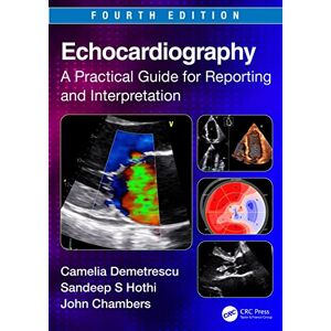 Demetrescu, Camelia Echocardiography: A Practical Guide for Reporting and Interpretation Demetrescu, Camelia Echocardiography: A Practical Guide for Reporting and Interpretation
