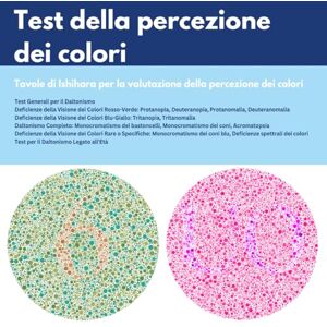 Ishida, Satoschi Test della visione dei colori : Tavole di Ishihara per la valutazione della percezione cromatica: deficit rosso-verde, deficit blu-giallo, deficit ... disturbi rari della percezione dei colori Ishida, Satoschi Test della visione dei colori : Tavole di Ishihara per la valutazione della percezione cromatica: deficit rosso-verde, deficit blu-giallo, deficit ... disturbi rari della percezione dei colori