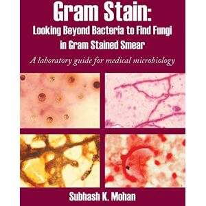 Mohan, Subhash K. Gram Stain: Looking Beyond Bacteria to Find Fungi in Gram Stained Smear: A laboratory guide for medical microbiology Mohan, Subhash K. Gram Stain: Looking Beyond Bacteria to Find Fungi in Gram Stained Smear: A laboratory guide for medical microbiology