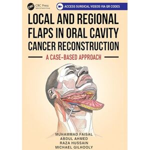 Faisal, Muhammad Local and Regional Flaps in Oral Cavity Cancer Reconstruction: A case-based approach Faisal, Muhammad Local and Regional Flaps in Oral Cavity Cancer Reconstruction: A case-based approach