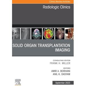Elsevier Solid organ transplantation imaging, An Issue of Radiologic Clinics of North America, E-Book (The Clinics: Radiology) Elsevier Solid organ transplantation imaging, An Issue of Radiologic Clinics of North America, E-Book (The Clinics: Radiology)