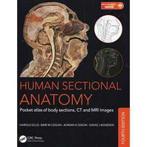 Logan, Bari M. Human Sectional Anatomy: Pocket atlas of body sections, CT and MRI images, Fourth edition Logan, Bari M. Human Sectional Anatomy: Pocket atlas of body sections, CT and MRI images, Fourth edition