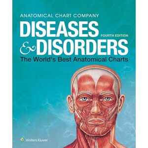 Anatomical Chart Company Diseases & Disorders: The World's Best Anatomical Charts (The World's Best Anatomical Chart Series) Anatomical Chart Company Diseases & Disorders: The World's Best Anatomical Charts (The World's Best Anatomical Chart Series)