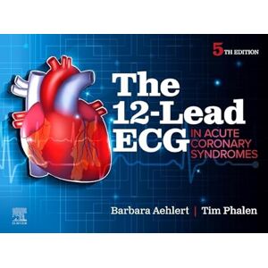 Aehlert MSEd BSPA RN, Barbara J. The 12-Lead ECG in Acute Coronary Syndromes Aehlert MSEd BSPA RN, Barbara J. The 12-Lead ECG in Acute Coronary Syndromes