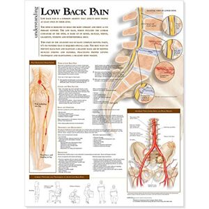 Anatomy Stuff Understanding Low Back Pain Anatomical Chart Anatomy Stuff Understanding Low Back Pain Anatomical Chart