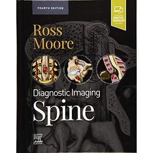 Ross MD, Jeffrey S. Diagnostic Imaging: Spine Ross MD, Jeffrey S. Diagnostic Imaging: Spine