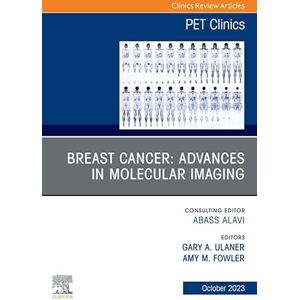 Elsevier Breast Cancer: Advances in Molecular Imaging, An Issue of PET Clinics, E-Book (The Clinics: Radiology) Elsevier Breast Cancer: Advances in Molecular Imaging, An Issue of PET Clinics, E-Book (The Clinics: Radiology)