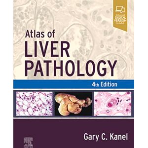 Elsevier Atlas of Liver Pathology E-Book (Atlas of Surgical Pathology) Elsevier Atlas of Liver Pathology E-Book (Atlas of Surgical Pathology)