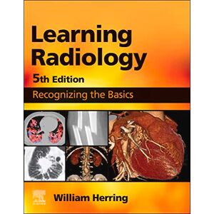 Elsevier Learning Radiology E-Book Elsevier Learning Radiology E-Book