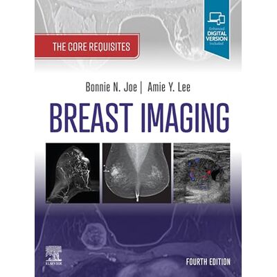 Elsevier Breast Imaging, E-Book: The Core Requisites Elsevier Breast Imaging, E-Book: The Core Requisites