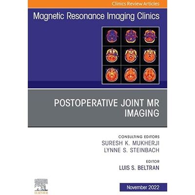 Elsevier Postoperative Joint MR Imaging, An Issue of Magnetic Resonance Imaging Clinics of North America, E-Book (The Clinics: Internal Medicine) Elsevier Postoperative Joint MR Imaging, An Issue of Magnetic Resonance Imaging Clinics of North America, E-Book (The Clinics: Internal Medicine)
