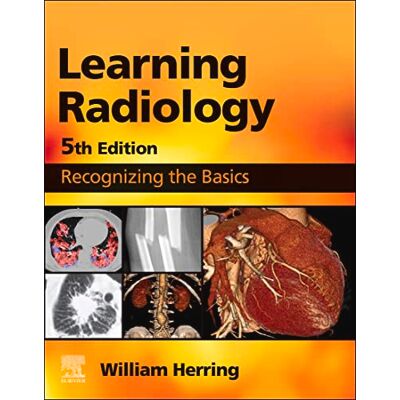 Elsevier Learning Radiology E-Book Elsevier Learning Radiology E-Book