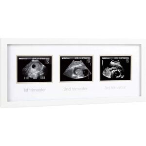 Pearhead Ultrasound Trimester Photo Frame - White Pearhead Ultrasound Trimester Photo Frame - White