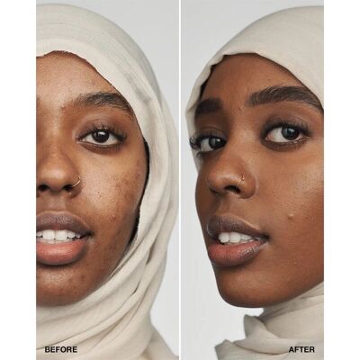 Clinique Even Better Clinical Serum Foundation SPF 20 Spice - Foundation Clinique Even Better Clinical Serum Foundation SPF 20 Spice - Foundation