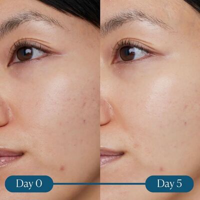 Elemis Dynamisches Peeling Super-C Serum (30ml) Elemis Dynamisches Peeling Super-C Serum (30ml)