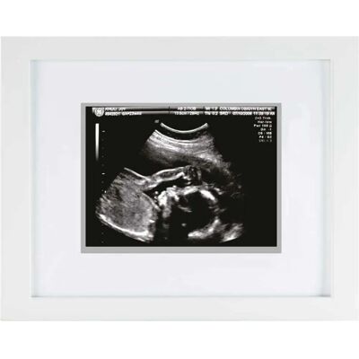 Pearhead Marco Ecografía - Photo Frame Pearhead Marco Ecografía - Photo Frame
