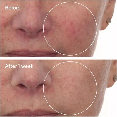 Murad Cellulose Hydration Repair Serum - Serum Murad Cellulose Hydration Repair Serum - Serum