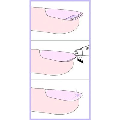 BAUSCH Nagelversieglungsgerät - Nagelverstärkungsgerät BAUSCH Nagelversieglungsgerät - Nagelverstärkungsgerät