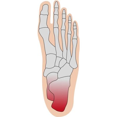 Dr. Hundt Fersenschutzbandage - Fersenbandage Dr. Hundt Fersenschutzbandage - Fersenbandage
