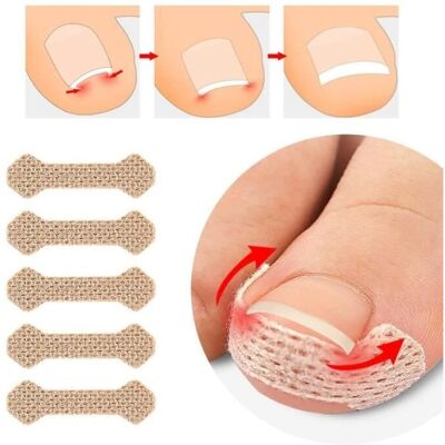 INF Marque INF Pansement pour ongles incarnés - Pansement pour ongles incarnés - Publicité INF Marque INF Pansement pour ongles incarnés - Pansement pour ongles incarnés - Publicité