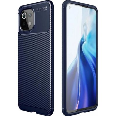 Screenguard - Xiaomi Mi 11 Lite - Carbon Design - Smartphone Hülle Screenguard - Xiaomi Mi 11 Lite - Carbon Design - Smartphone Hülle